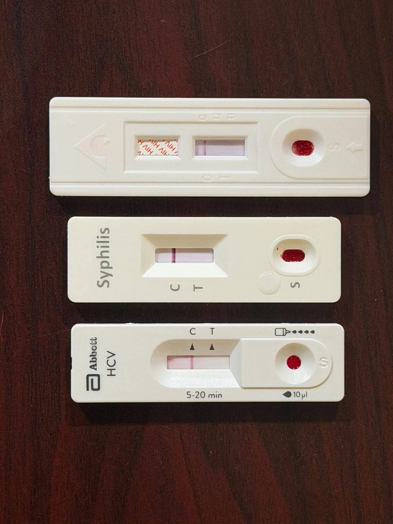 Confirman seis casos del VIH, en El Mante durante